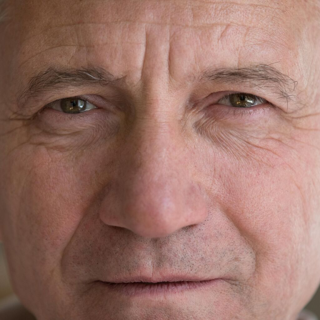 La dégénérescence maculaire liée à l'âge (DMLA) : quelles en sont les causes ?