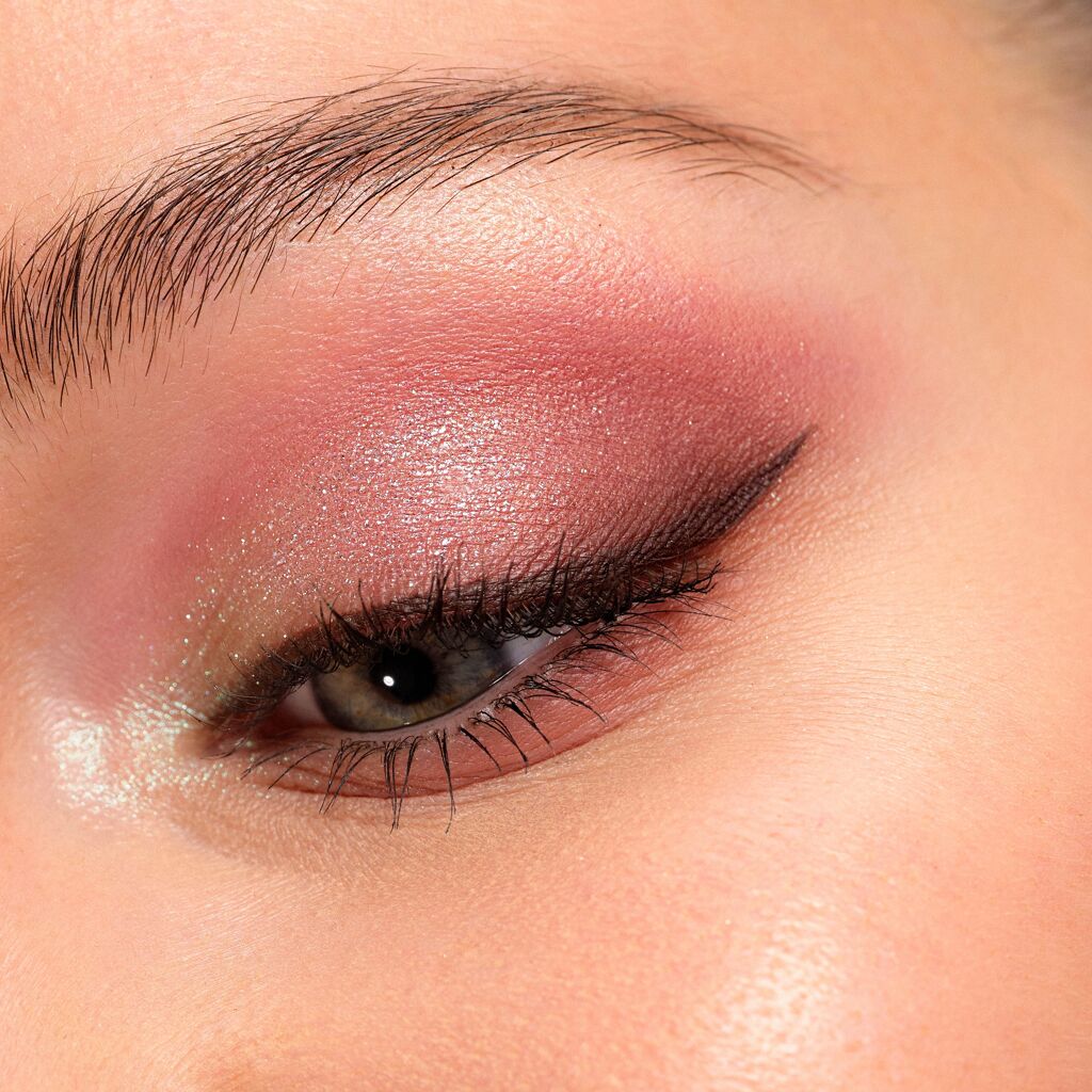 Kératocône : qu’est-ce que c’est ?