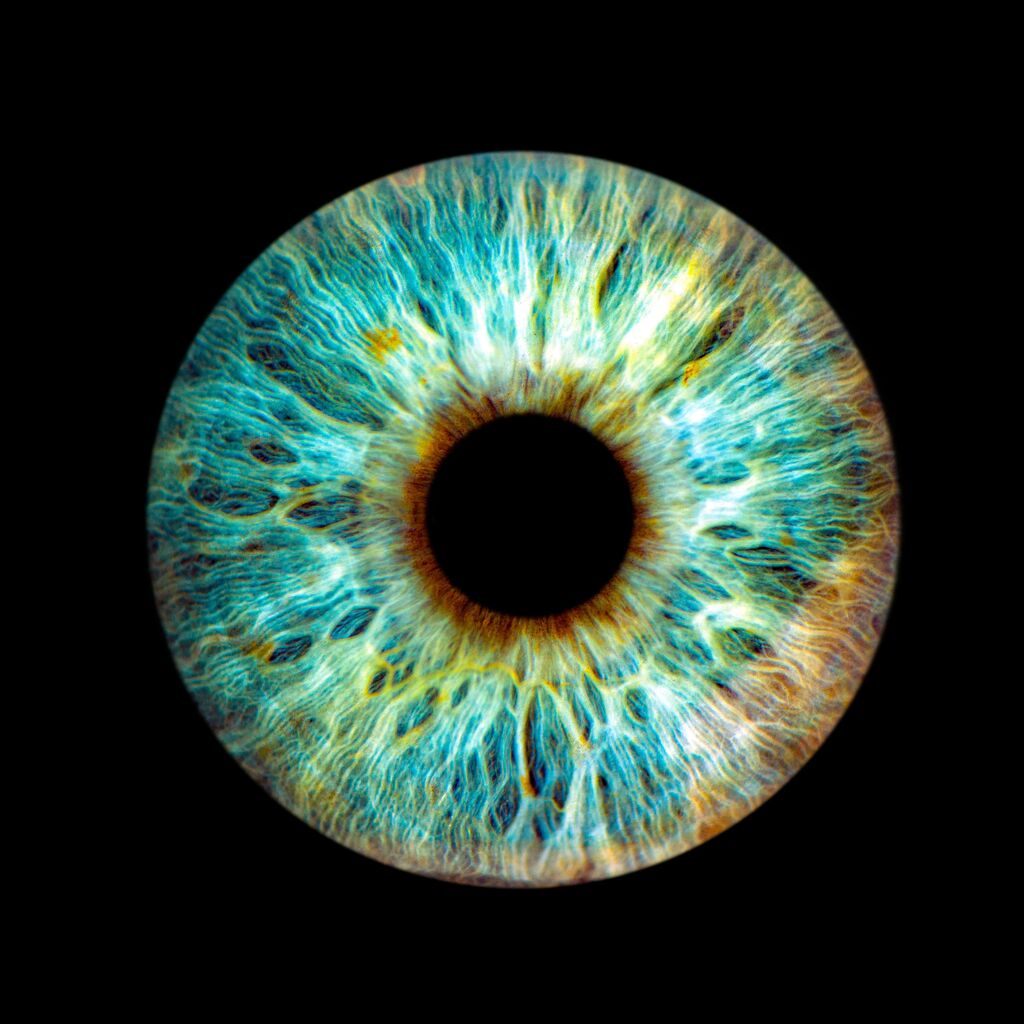 La myodésopsie : causes, symptômes et traitement