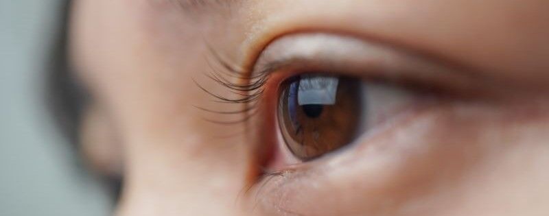 Les yeux jaunes, un signe de mauvaise santé ?